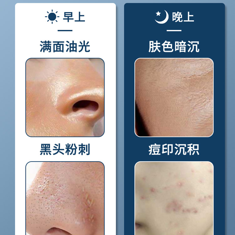 百亿补贴福利欧珀仕氨基酸海盐男士洗面奶400ml图2
